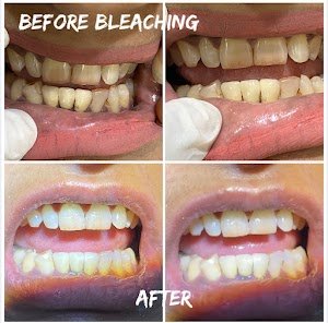 Smiline Dental Care Dr Priyanka Aggarwal place picture